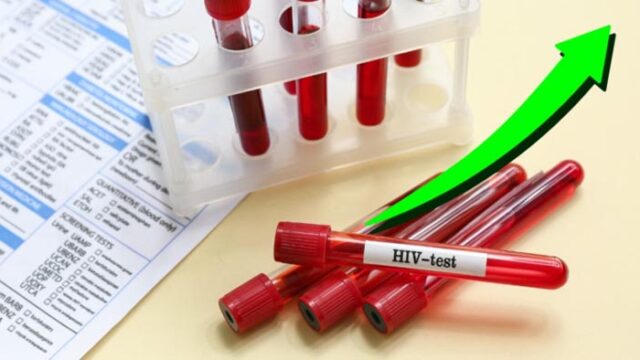 Sudden Increase in HIV Cases in Bangladesh