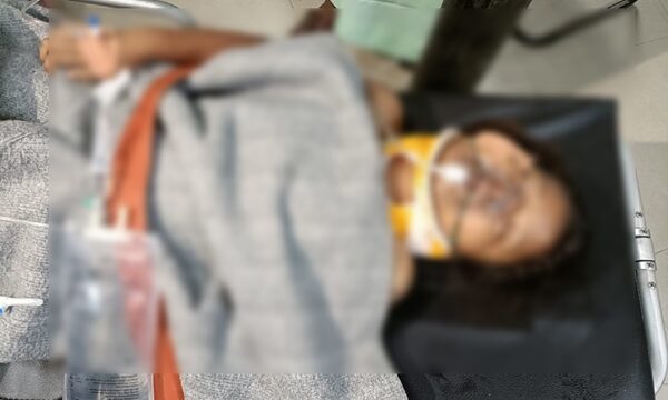 টেকনাফে গুলিবিদ্ধ শিশুটিকে পাঠানো হচ্ছে ঢাকায়, মাথার খুলির এক পাশ খুলে রাখা হয়েছে