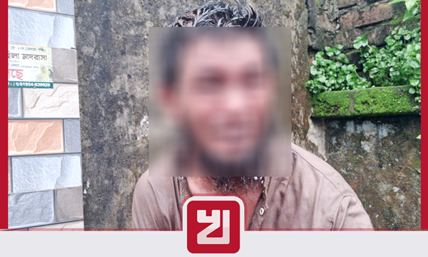 শিশু ধর্ষণচেষ্টার অভিযোগে অটোরিকশাচালকের পুরুষাঙ্গে মরিচের গুঁড়া লাগাল এলাকাবাসী