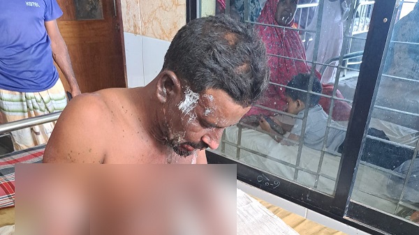 সাক্ষীর গায়ে পেট্রল ঢেলে আগুন দিল আসামি