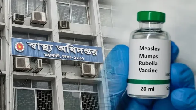 হামের উপসর্গে আরও ৫ জনের মৃত্যু, নতুন আক্রান্ত ১১৮০